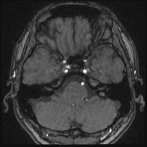 Click on the Serie image to view the images of VILLANUEVA, WILLIAM A.